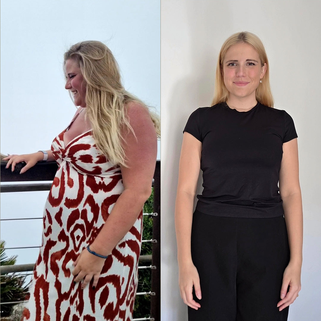 Before and after picture of Mia Sonderskov